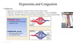 Pathology Made Easy 4 Hemodynamic Disorders [upl. by Fernand480]