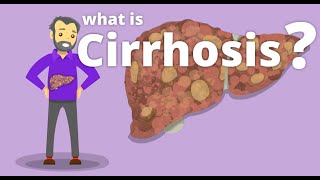 Cirrhosis  What is cirrhosis [upl. by Tombaugh]