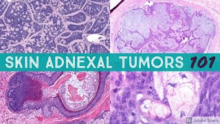 Skin Adnexal Tumors 101 A Basic Approach for General Pathologists [upl. by Souvaine]