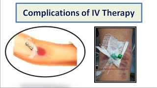 Complications of IV Therapy [upl. by Idnaj]