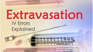 Extravasation  IV Infiltration Errors Explained Doctor Interview [upl. by Ipoillak]