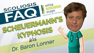 Scoliosis FAQ  Scheuermanns Kyphosis [upl. by Marucci]