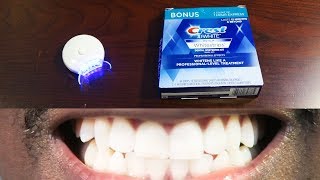 How To Whiten Teeth Easy • AuraGlow LED Light amp Crest 3D Whitestrips [upl. by Yhtorod]