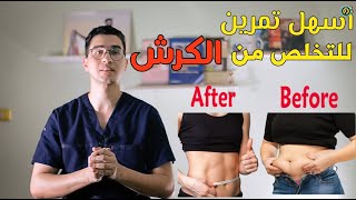 أسهل تمرين تقدر تعمله في البيت للتخلص من الكرش  ‫vacuum exercise ‬‎ [upl. by Kcirddec913]