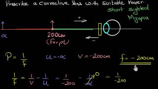 Numerical on myopia Hindi  Human eye and the colourful world  Physics  Khan Academy [upl. by Haisoj524]