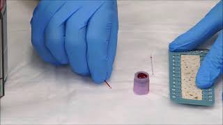 How to Measure the Hematocrit [upl. by Gone111]