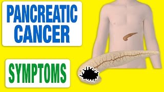 Pancreatic Cancer  All Symptoms [upl. by Appleby]