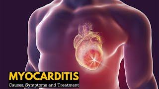 Myocarditis Causes Signs and Symptoms Diagnosis Treatment [upl. by Fesoy]