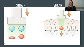 Ultrasound Elastography Explained Strain and Shear [upl. by Batsheva33]