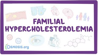 Familial hypercholesterolemia  an Osmosis Preview [upl. by Ellenrahs494]