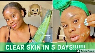 I USED FRESH ALOE VERA GEL ON MY SKIN FOR 5 DAYS amp THIS HAPPENED [upl. by Eceinhoj]