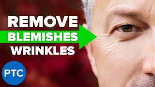 A Powerful Trick to INSTANTLY Remove Wrinkles and Blemishes in Photoshop [upl. by Silvain862]