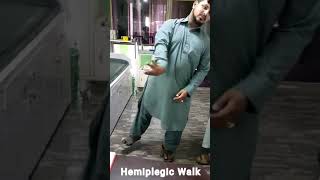 Hemiplegic Cerebral palsy  Hemiplegic gait [upl. by Ainehta]