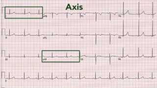 ECG interpretation recognising normal [upl. by Oreste]