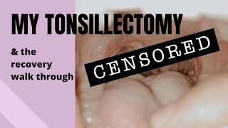 Waldeyers ring Tonsils Lingual Tubal Adenoid Palatine Anatomy USMLE NCLEX MCAT 3 Minutes [upl. by Adrianna929]