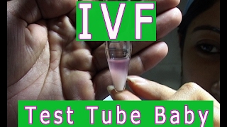 Test Tube Baby [upl. by Arvo]