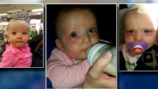 Babysitter accused of child abuse [upl. by Amalia801]