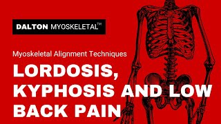 Lordosis Kyphosis and Low Back Pain [upl. by Dougald530]