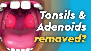 Tonsil and Adenoid Anatomy [upl. by Anilosi]