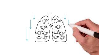 Everything you need to know about the ventilation perfusion ratio [upl. by Modie]