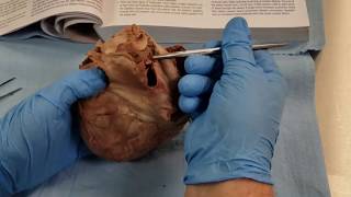 External and Internal Features of the Heart [upl. by Heringer]