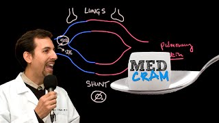 Ventriculomegaly  Hydrocephalus and VP Shunt [upl. by Lyndel]