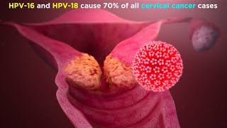 Human Papillomavirus HPV [upl. by Lindahl]