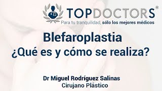 Blefaroplastia cómo funciona el levantamiento de párpados [upl. by Aneladgam]