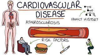 Understanding Cardiovascular Disease Visual Explanation for Students [upl. by Ealasaid]