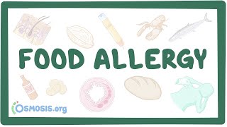 Managing Food Allergies in the School Setting [upl. by Glassco826]