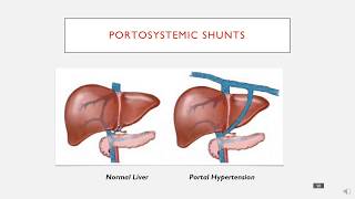 Transesophageal Echocardiography Shunts and Bubble Study [upl. by Novj]