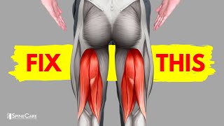 How to Fix a Tight Hamstring for Good [upl. by Egrog]