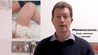 Meningococcal Disease Signs Symptoms and Vaccines [upl. by Wadell]