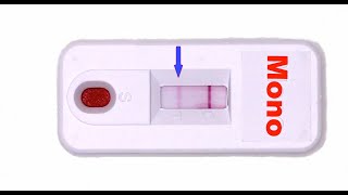 Rapid Mono Test How Does it Work [upl. by Berky682]