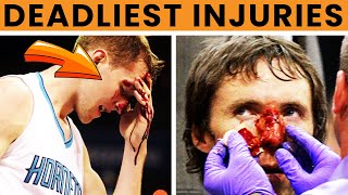 10 Worst NBA Injuries of alltime [upl. by Rinaldo940]