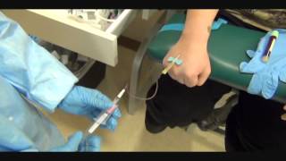 Butterfly Hand Phlebotomy Outside Vein Activationwmv [upl. by Faucher]