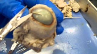 NEW  Cow Eye Dissection Video Lab Series [upl. by Neelsaj114]