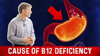 Vitamin B12 Deficiency The most common Cause – Dr Berg [upl. by Kippie]