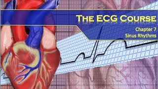 The ECG Course  Sinus Rhythms [upl. by Hickie]