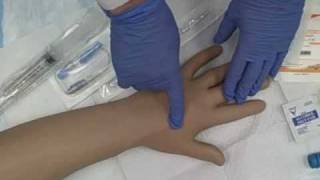 Intravenous IV Saline Lock Insertion [upl. by Karl]