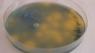 DIY BIO How to obtain Acetobacter amp making Bromothymol blue Agar [upl. by Ahsocin859]