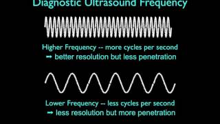 Ultrasound Physics Basics Physics and Image Generation [upl. by Lydnek]