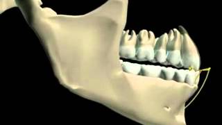 Mandibular Movement 3D [upl. by Beore293]