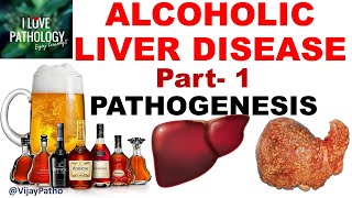 ALCOHOLIC LIVER DISEASE Part 1 Pathogenesis [upl. by Srednas]