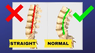 How To Correct Straightening Of Lumbar Spine FIX LOSS OF LUMBAR LORDOSIS  Dr Walter Salubro [upl. by Drida]