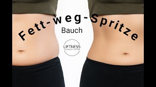 Fettwegspritze Bauch [upl. by Anahtor]