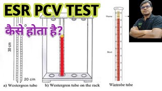 ESR  PCV  Erythocyte sedimentation rate  packed cell valume [upl. by Ahsercal768]