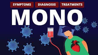 What is MONO Symptoms Diagnosis amp Treatments [upl. by Ciro]