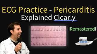 ECG Interpretation Practice  Pericarditis on EKG Explained [upl. by Ulane]