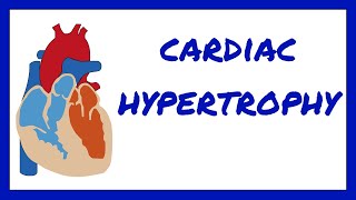 Cardiac Hypertrophy [upl. by Ifar]